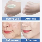 Herbal- Mint Acne Cream 1kg Fade Acne Scar Astringe Pores Repair Skin Problems Cosmetics OEM Beauty Salon Equipment - Image 5