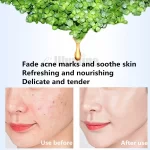 Skin Care Day Cream Mint Anti Allergy Repair Ice Crystal 1000g Repair Acne Recovery Elastic Cosmetics OEM Beauty Salon Equipment - Image 2